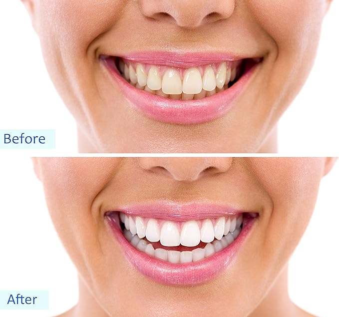 Activated Char coal Powder Teeth Whitening